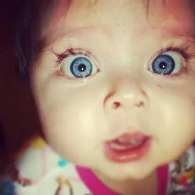 ما هو علاج إلتهاب العيون ؟؟