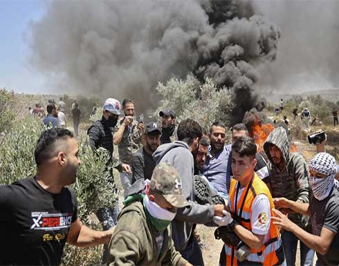 شاهد : إصابة 277 فلسطينيا برصاص الجيش الإسرائيلي شاهد : إصابة 277 فلسطينيا برصاص الجيش الإسرائيلي