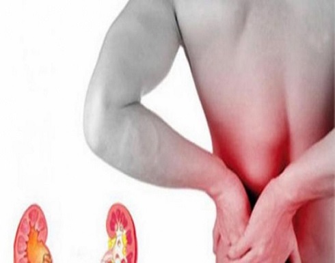 تعرف على أعراض حصوات الكلى وأنواعها تعرف على أعراض حصوات الكلى وأنواعها