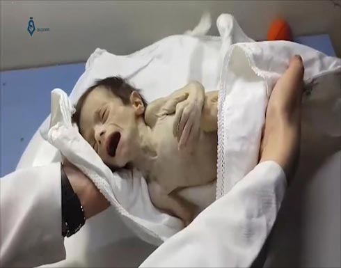 مطالبة أممية بإجلاء 400 مريض من غوطة دمشق مطالبة أممية بإجلاء 400 مريض من غوطة دمشق