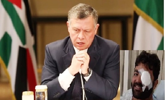 الملك يوجه بمتابعة الحالة الصحية للصحفي الفلسطيني عمارنة الملك يوجه بمتابعة الحالة الصحية للصحفي الفلسطيني عمارنة