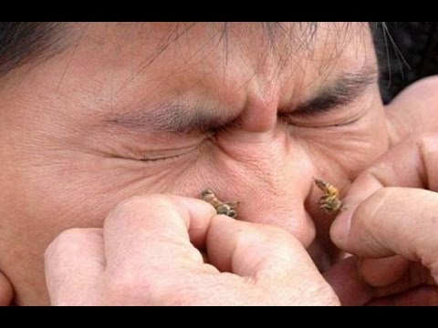 رسول الله لا ينطق عن الهوى.. الكشف عن علاج نبوي فعال للتخلص من التهاب الجيوب الأنفية