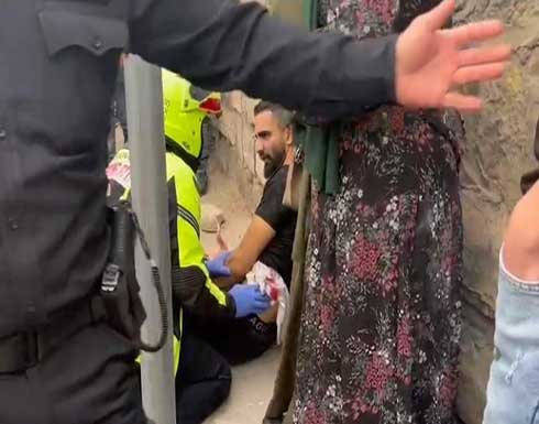 إصابة شاب فلسطيني برصاص مستوطن في الشيخ جراح .. بالفيديو إصابة شاب فلسطيني برصاص مستوطن في الشيخ جراح .. بالفيديو