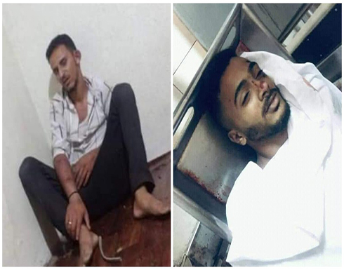 اليمن.. 11 محاميا يتطوعون للدفاع في قضية تعذيب عبدالله الأغبري (فيديو) اليمن.. 11 محاميا يتطوعون للدفاع في قضية تعذيب عبدالله الأغبري (فيديو)