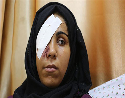 شابة من غزة تفقد عينها برصاصة إسرائيلية شابة من غزة تفقد عينها برصاصة إسرائيلية
