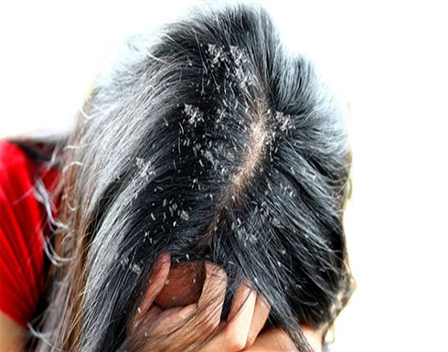تعرفي على وصفة اللبن والبيض لترطيب الشعر تعرفي على وصفة اللبن والبيض لترطيب الشعر