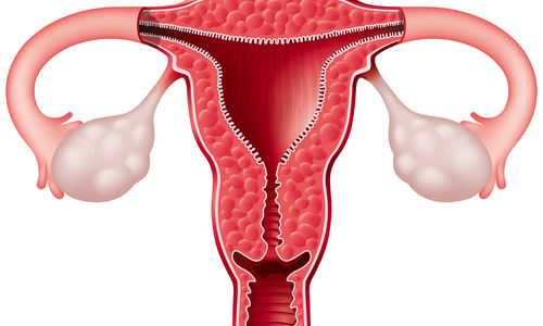 النساء فوق سن الـ50 أكثر عرضة للإصابة بسرطان الرحم
