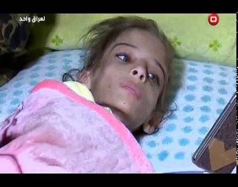 أمٌّ تعذّب ابنتها بقلع الشعر ونزع الأظافر.. وتفاصيل أكثر فظاعة! أمٌّ تعذّب ابنتها بقلع الشعر ونزع الأظافر.. وتفاصيل أكثر فظاعة!
