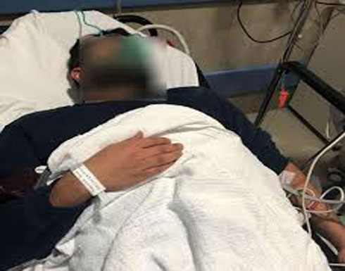 بالفيديو - نجم شهير يعاني من حالة طبية خطيرة وغريبة بالفيديو - نجم شهير يعاني من حالة طبية خطيرة وغريبة