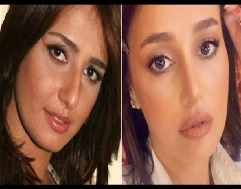 شاهد الفرق .. 4 نجمات يلجأن إلى التجميل في رمضان .. ياسمين صبري اولهن شاهد الفرق .. 4 نجمات يلجأن إلى التجميل في رمضان .. ياسمين صبري اولهن
