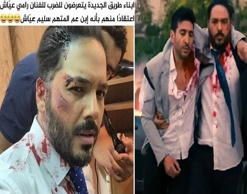 اضطرابات كادت تحدث في لبنان بسبب صورة مطرب مضرّج بالدم اضطرابات كادت تحدث في لبنان بسبب صورة مطرب مضرّج بالدم
