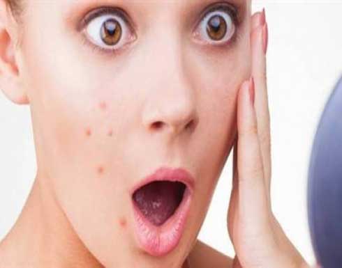 تعانين من البثور؟ طبقي هذه الحيلة لاخفائها تعانين من البثور؟ طبقي هذه الحيلة لاخفائها