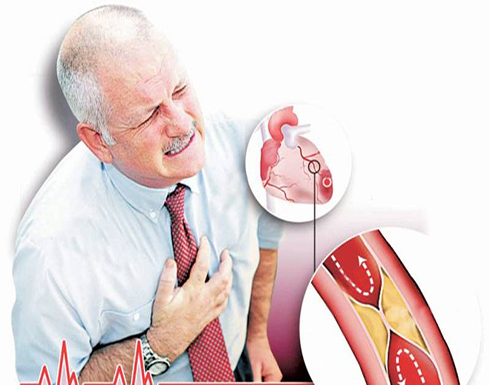 أعراض تدل على احتمال حدوث نوبة قلبية