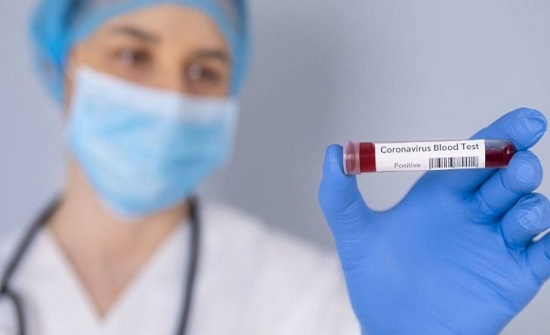 920 اصابة جديدة بفيروس كورونا في الأردن 920 اصابة جديدة بفيروس كورونا في الأردن
