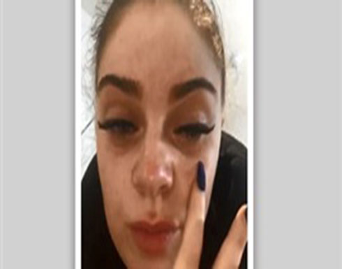 فتاة تفقد بصرها ساعتين بسبب الرموش الصناعية (صور) فتاة تفقد بصرها ساعتين بسبب الرموش الصناعية (صور)