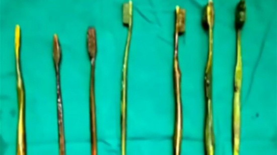 ابتلعت 7 فراشي أسنان لرفضها الزواج المدبّر ابتلعت 7 فراشي أسنان لرفضها الزواج المدبّر