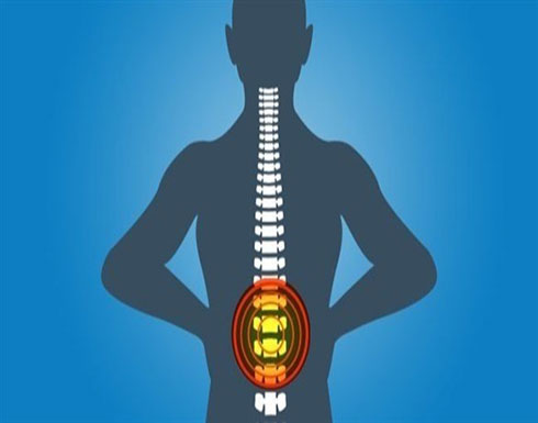 التشخيص الطبي لآلام الظهر ضروري