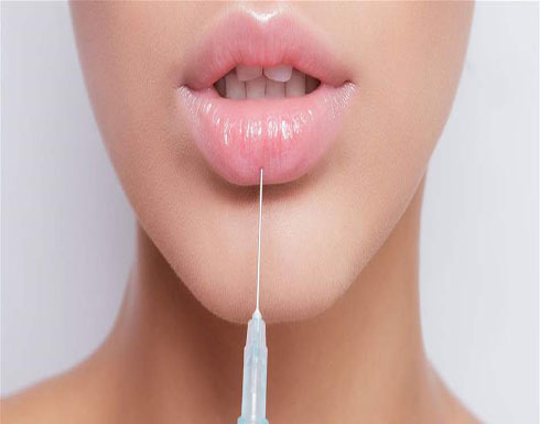 عملية تجميل فاشلة لشفتيها.. لن تصدقوا كيف بدت عملية تجميل فاشلة لشفتيها.. لن تصدقوا كيف بدت
