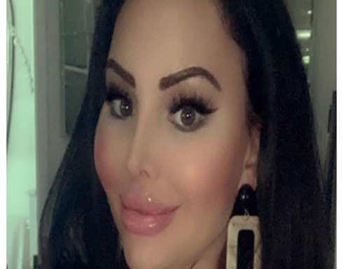 100 عملية تجميل في 15 عامًا.. سيدة تنفق ثروة طائلة لتتحول إلى «دمية بشرية» .. صور 100 عملية تجميل في 15 عامًا.. سيدة تنفق ثروة طائلة لتتحول إلى «دمية بشرية» .. صور
