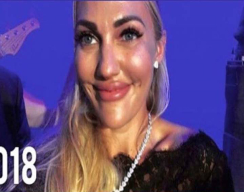 بالصورة :السلطانة هُيام تزيل آثار الحقن من وجهها وتعود إلى شكلها القديم بالصورة :السلطانة هُيام تزيل آثار الحقن من وجهها وتعود إلى شكلها القديم
