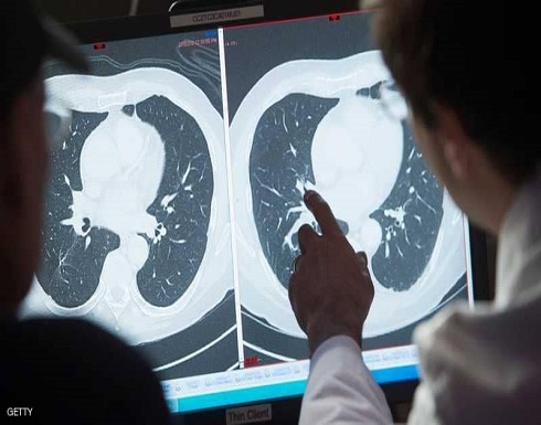 "تقنية طبية" جديدة تفتح باب الأمل لمرضى السرطان "تقنية طبية" جديدة تفتح باب الأمل لمرضى السرطان