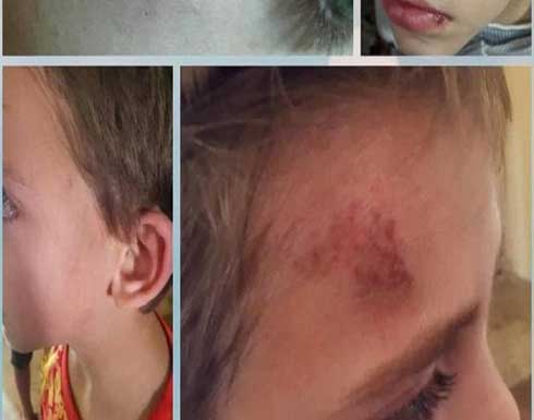 شاهد.. لبنانية تعتدي بوحشية على طفل سوري وتهدد بترحيله شاهد.. لبنانية تعتدي بوحشية على طفل سوري وتهدد بترحيله