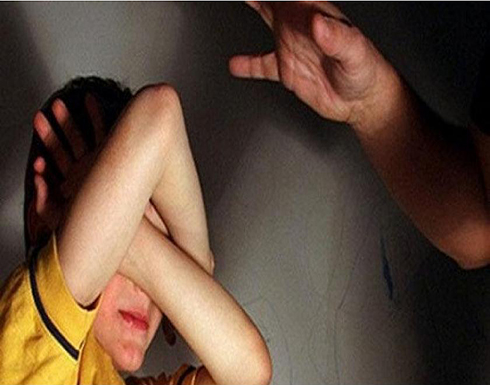 تأخر عن المنزل ... سوري يحرق وجه وذراع ابنه بسكين محمّى .. صورة تأخر عن المنزل ... سوري يحرق وجه وذراع ابنه بسكين محمّى .. صورة