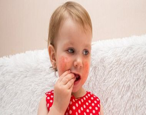 علامات تظهر على طفلك وتدل على إصابته بـ حساسية الصدر علامات تظهر على طفلك وتدل على إصابته بـ حساسية الصدر