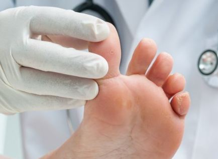 هكذا تتجنبون الإصابة بمسمار القدم