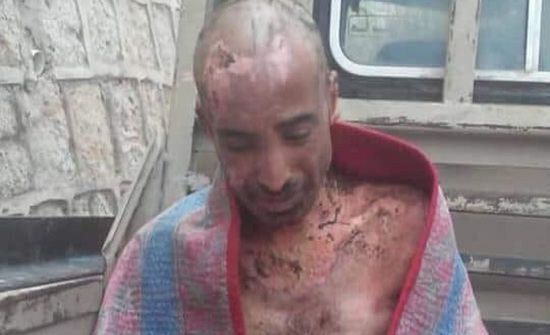+18 صور صادمة.. هذا ما فعله الحوثي بمعتقل يمني +18 صور صادمة.. هذا ما فعله الحوثي بمعتقل يمني