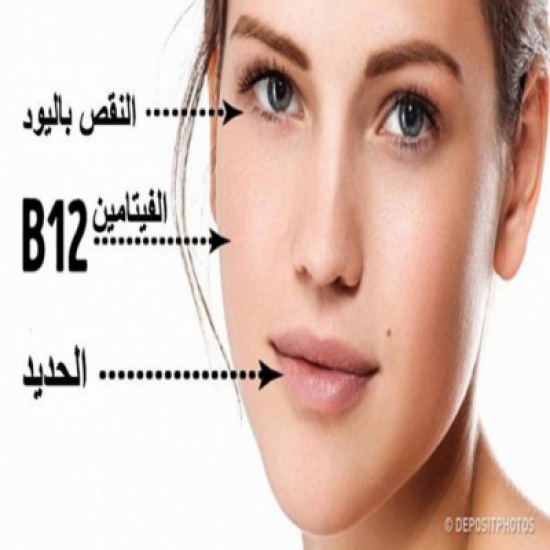 5 علامات عن النقص بالفيتامينات مكتوبة على وجهك 5 علامات عن النقص بالفيتامينات مكتوبة على وجهك