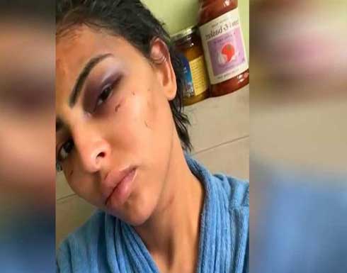 خطف واغتصاب مصرية في الكويت.. والمتهم "سوابق" خطف واغتصاب مصرية في الكويت.. والمتهم "سوابق"
