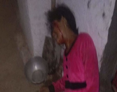 جريمة مروعة في صنعاء.. عذبوا أختهم حتى الموت وصوروها جريمة مروعة في صنعاء.. عذبوا أختهم حتى الموت وصوروها