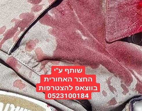إصابة خطيرة لجندي إسرائيلي بالقرب من السياج الفاصل شرق غزة .. شاهد إصابة خطيرة لجندي إسرائيلي بالقرب من السياج الفاصل شرق غزة .. شاهد