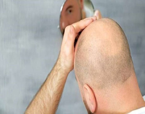 دراسة جديدة: الرجل الأصلع ناجح في حياته وأكثر قوة وحكمة دراسة جديدة: الرجل الأصلع ناجح في حياته وأكثر قوة وحكمة