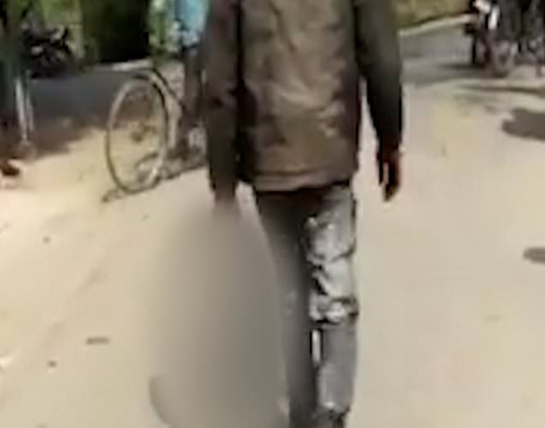 يسلم نفسه للشرطة وهو يحمل رأس الضحية المقطوع في نيبال يسلم نفسه للشرطة وهو يحمل رأس الضحية المقطوع في نيبال
