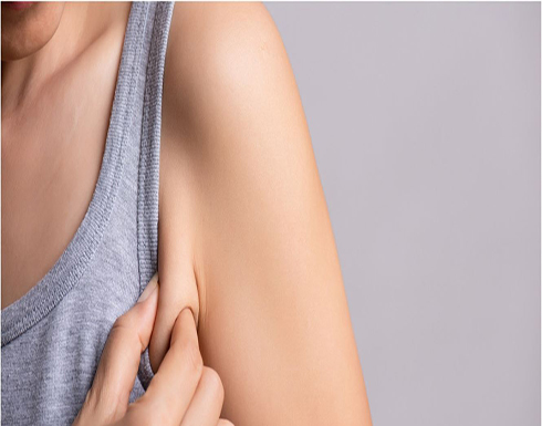 طرق لعلاجة الجلد المترهّل بعد خسارة الوزن طرق لعلاجة الجلد المترهّل بعد خسارة الوزن