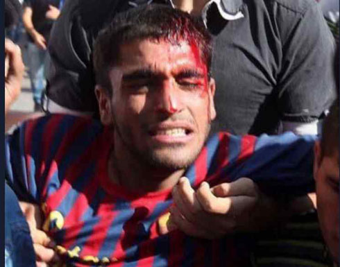 استشهاد فلسطيني معاق برصاص جيش الاحتلال في الضفة الغربية استشهاد فلسطيني معاق برصاص جيش الاحتلال في الضفة الغربية