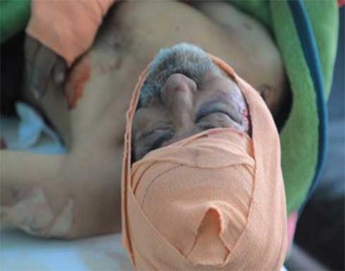 بينهم اطفال.. 15 قتيل وجريح مدني في قصف حوثي لمدينة مأرب بينهم اطفال.. 15 قتيل وجريح مدني في قصف حوثي لمدينة مأرب