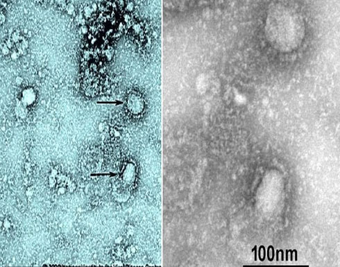 أول صورة لفيروس "كورونا" استخرجوه من أحد ضحاياه بالصين