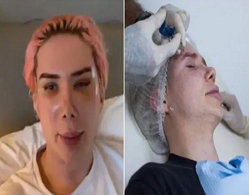 صور..مهووس يجري 18 عملية تجميل ليشبه مغني شهير صور..مهووس يجري 18 عملية تجميل ليشبه مغني شهير