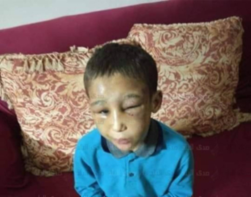 إكراه على شرب المخدرات وتعذيب وتصوير.. حكاية طفل مصر مع والديه إكراه على شرب المخدرات وتعذيب وتصوير.. حكاية طفل مصر مع والديه