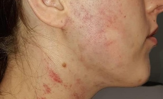 شاب يعتدي على خطيبته حتى فقدت الوعى بسبب غيرته.. صور شاب يعتدي على خطيبته حتى فقدت الوعى بسبب غيرته.. صور