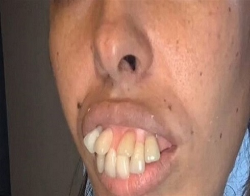بعد أعوام من السخرية والتنمر.. شاهد كيف أصبحت هذه الفتاة بعد أعوام من السخرية والتنمر.. شاهد كيف أصبحت هذه الفتاة