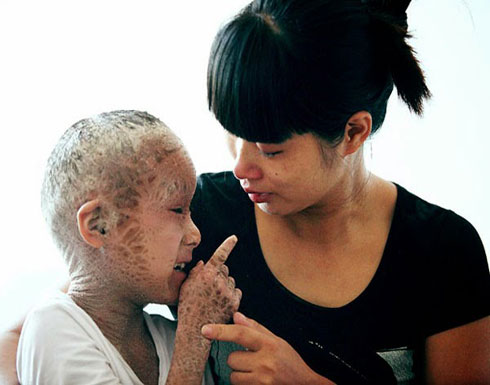 بالصور والفيديو .. الطفل السمكة