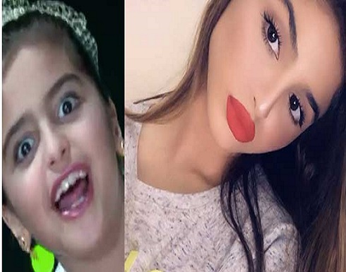 حلا الترك بين الامس واليوم.. من تقويم الاسنان الى العدسات والرموش الاصطناعية! حلا الترك بين الامس واليوم.. من تقويم الاسنان الى العدسات والرموش الاصطناعية!