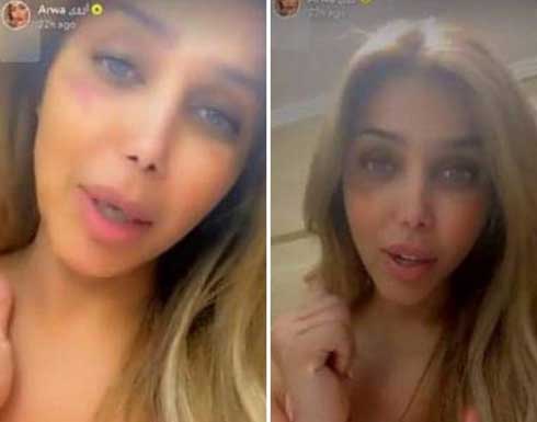 الفنانة اليمنية أروى تتعرض لحروق وكدمات وتشويه ووجهها .. شاهد الفنانة اليمنية أروى تتعرض لحروق وكدمات وتشويه ووجهها .. شاهد