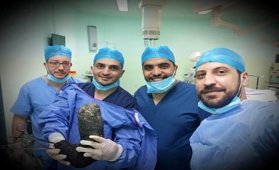 الأردن : إزالة 6 كغم شعر من بطن فتاة الأردن : إزالة 6 كغم شعر من بطن فتاة