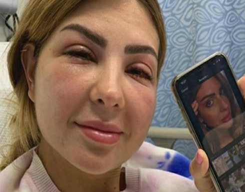 شاهد.. خطأ في عملية تجميل يتسبب في تشوه مدونة شهيرة شاهد.. خطأ في عملية تجميل يتسبب في تشوه مدونة شهيرة