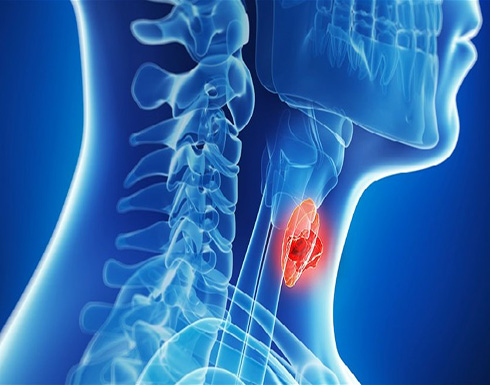 إحذروا هذه العوارض... قد تكشف عن سرطان الحنجرة الخبيث!